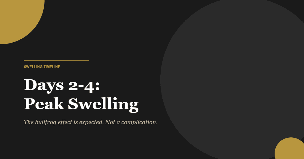 Kybella aftercare swelling timeline days 2-4 peak swelling bullfrog effect editorial illustration