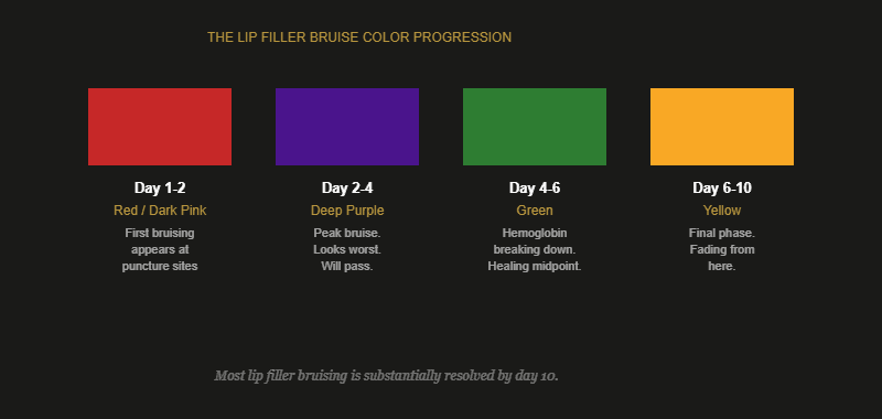 Color progression diagram showing lip filler bruising stages from red to purple to green to yellow over 10 days